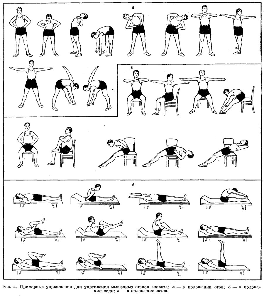 Примерные упражнения для укрепления мышечных стенок живота