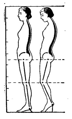 Схема, показывающая влияние обуви на высоком каблуке на осанку