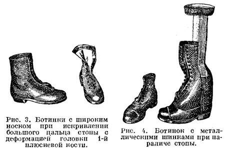 Ортопедическая обувь