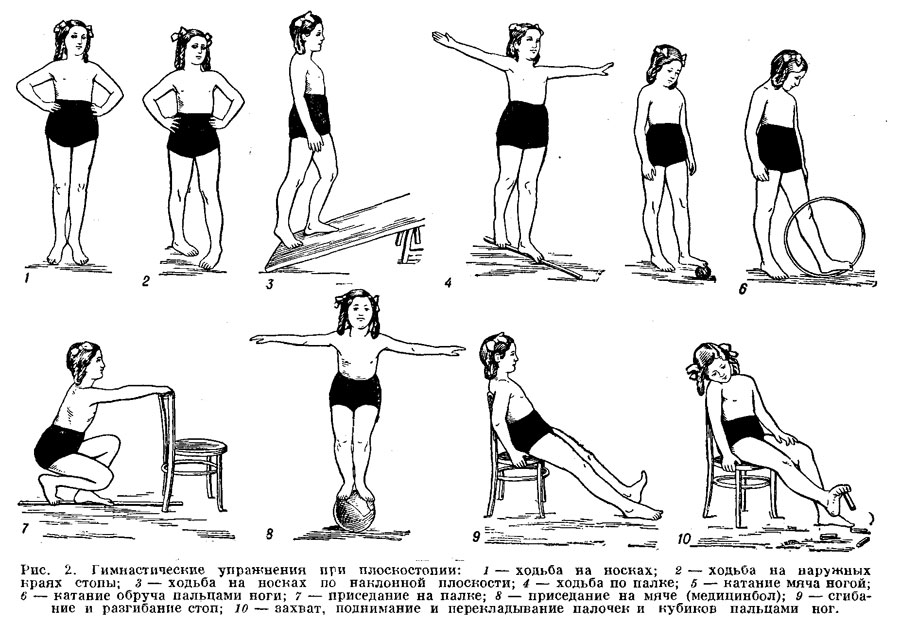 Гимнастические упражнения при плоскостопии