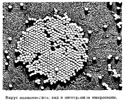 Вирус полимиелита